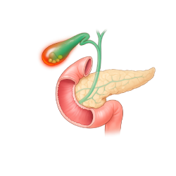 Illustration of the gallbladder